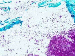 91013A | AFB, Fite Stain Kit  